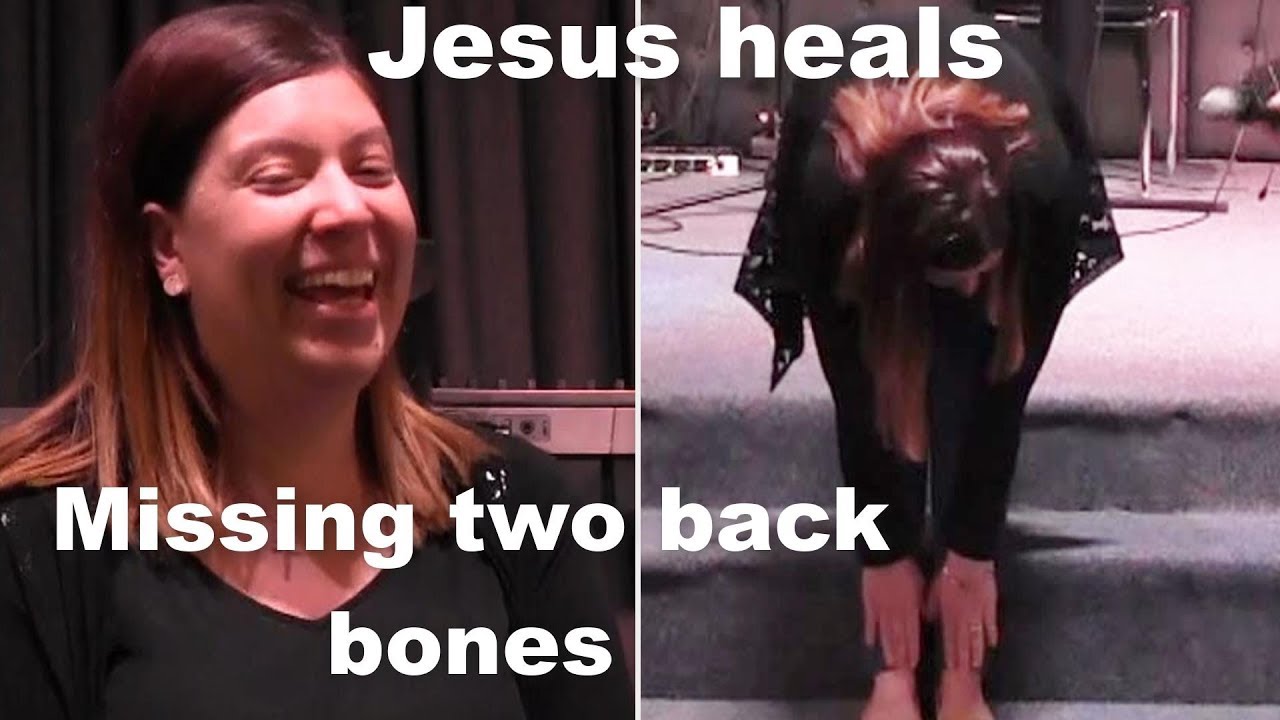 A MIRACLE: CONGENITAL DEFORMITY OF BACK HEALED