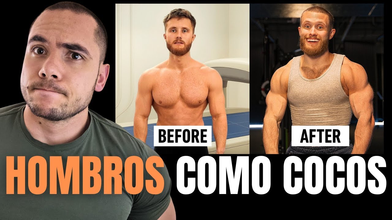 Como HACER CRECER Tus HOMBROS - 7 CONSEJOS