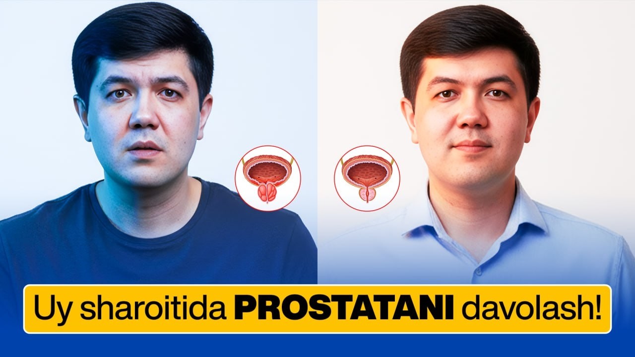 Prostatani uy sharoitida davolash: shifokor tavsiya qilgan to‘liq yo‘l xaritasi