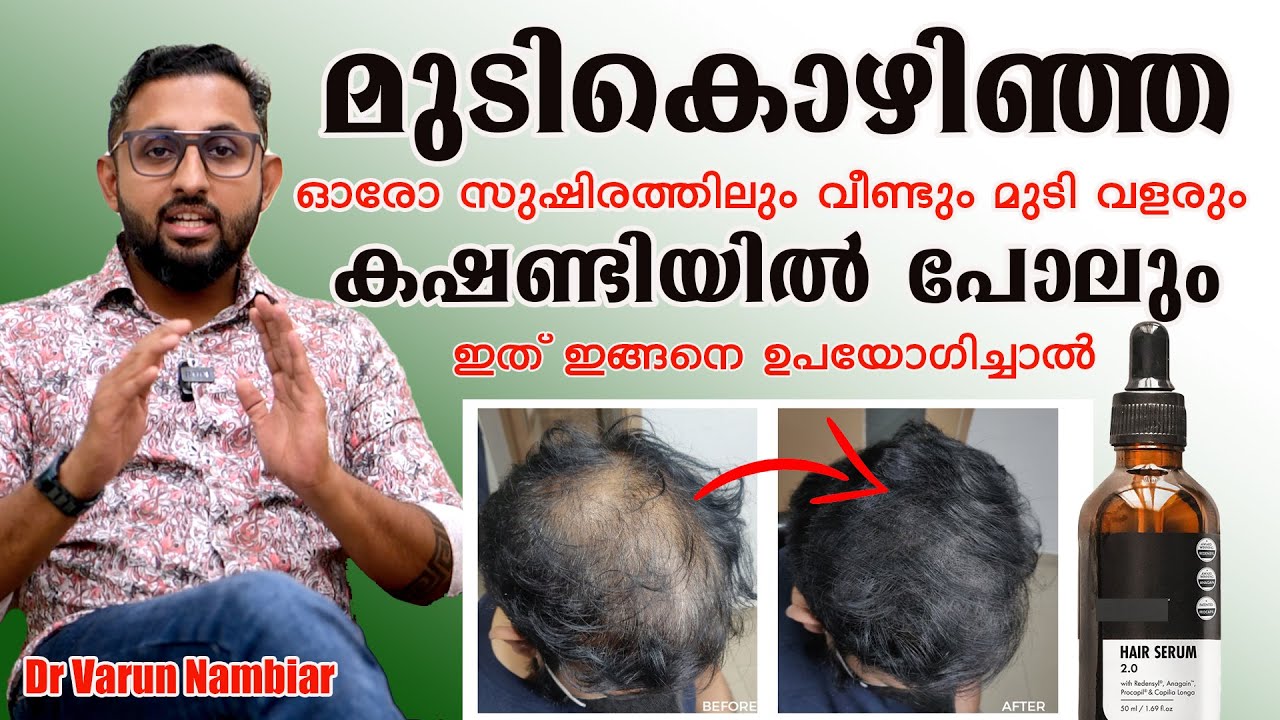 രാത്രി കിടക്കുന്നതിനു മുമ്പ് ഇത് രണ്ടുതുള്ളി തലയോട്ടിയിൽ പുരട്ടിയാൽ /Dr Varun Nambiar