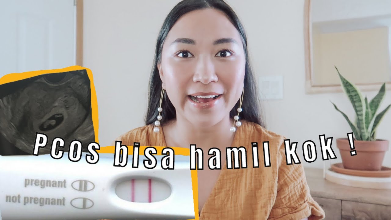 Sukses program hamil PCOS cuman 1 bulan