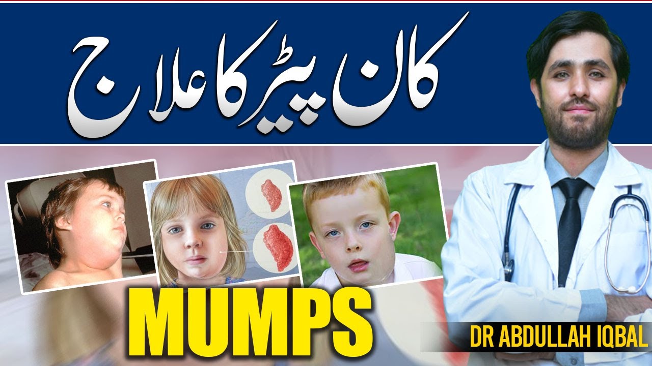 Mumps Treatment | Kan Paray Ka Ilaj in Urdu | Mumps Swelling Causes, Symptoms & Treatment in Urdu