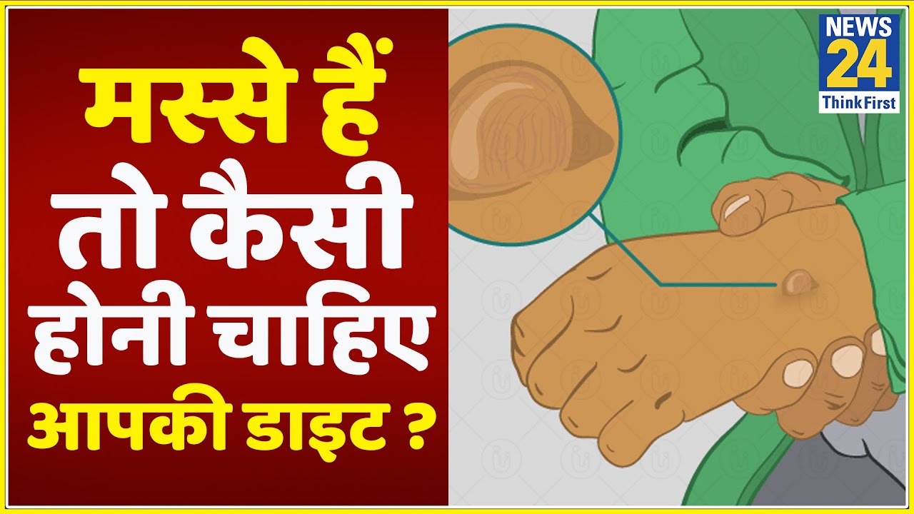 Sanjeevani : जानिए मस्से हैं तो क्या खाएं और क्या ना खाएं ? || News24