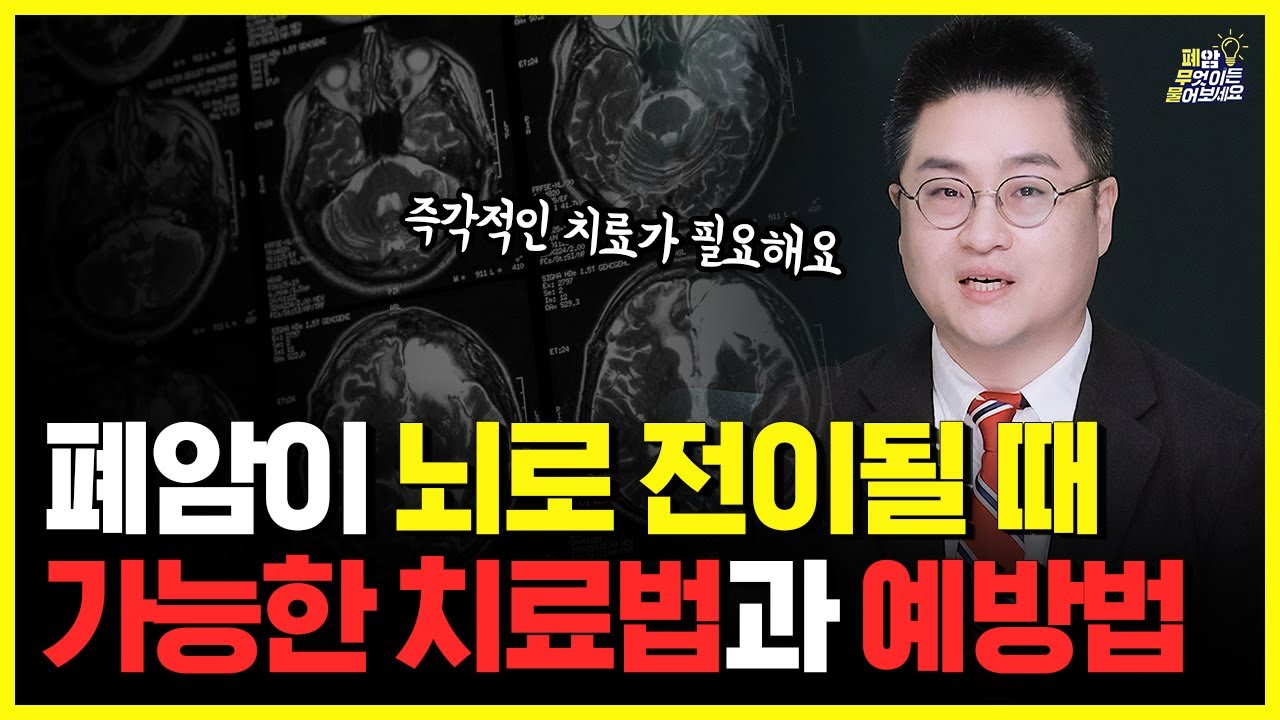 폐암 뇌전이, 더 이상 '말기'가 아니다! | 놓치면 안 되는 치료 시기와 방법
