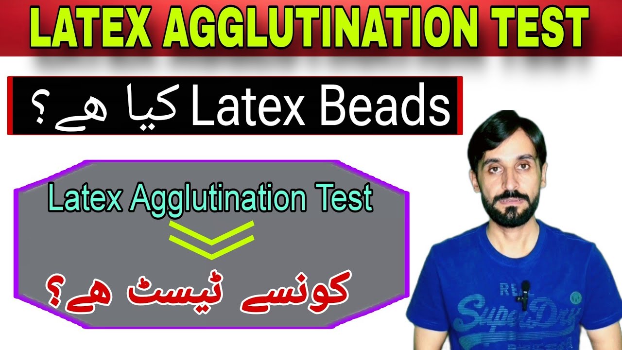 Latex Agglutination Test