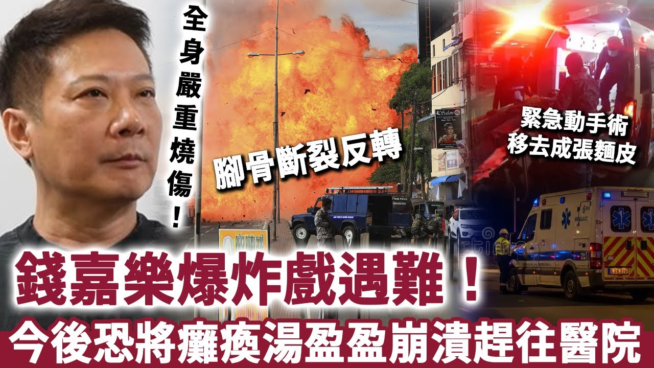 錢嘉樂爆炸戲遇難！全身嚴重燒傷，動手術移去成張麵皮，腳骨斷裂反轉今後恐將癱瘓，湯盈盈崩潰趕往醫院！