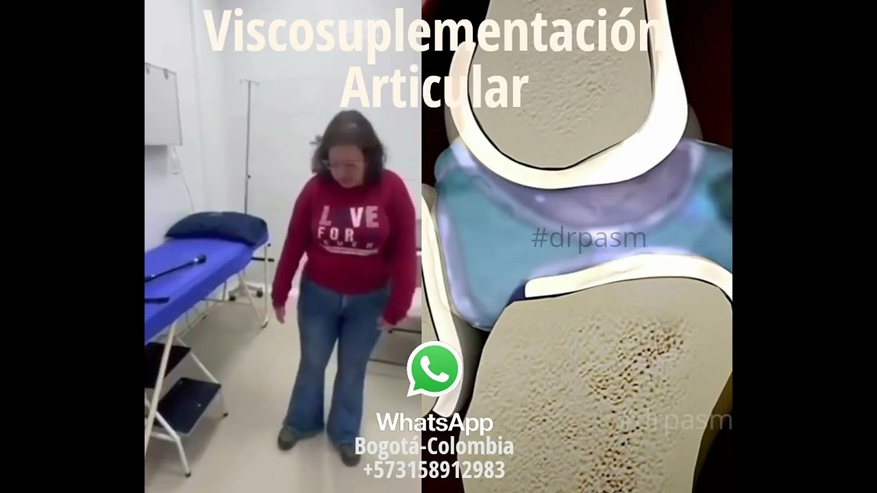 Antes de pensar en una prótesis, hoy la medicina ofrece estrategias de preservación articular