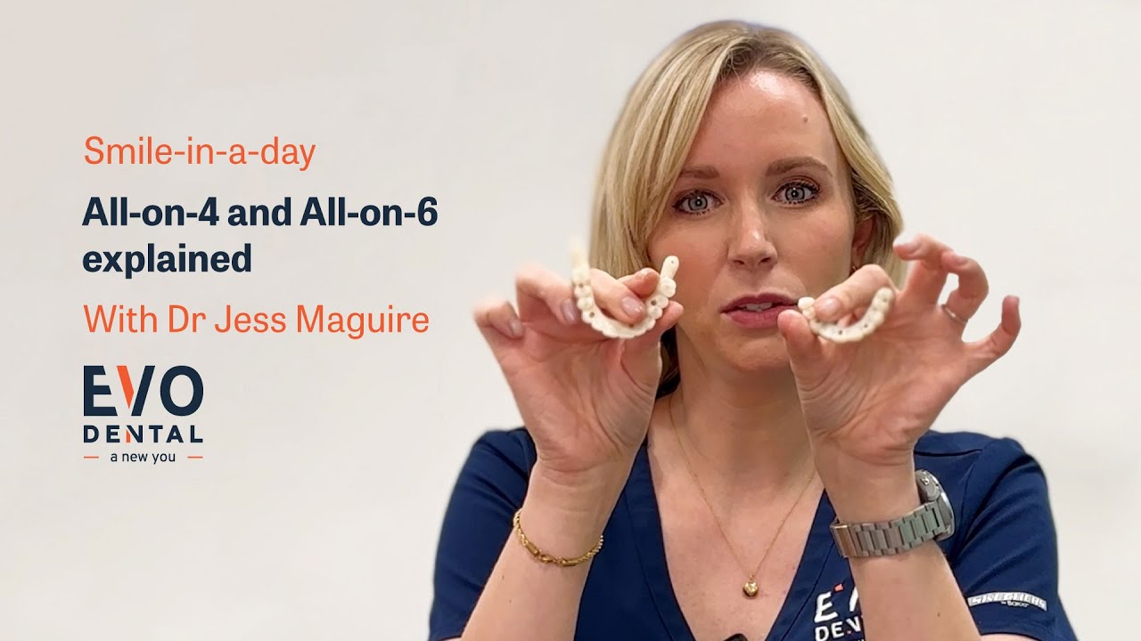 All-on-4 And All-on-6 Explained | Dental Implants | EvoDental