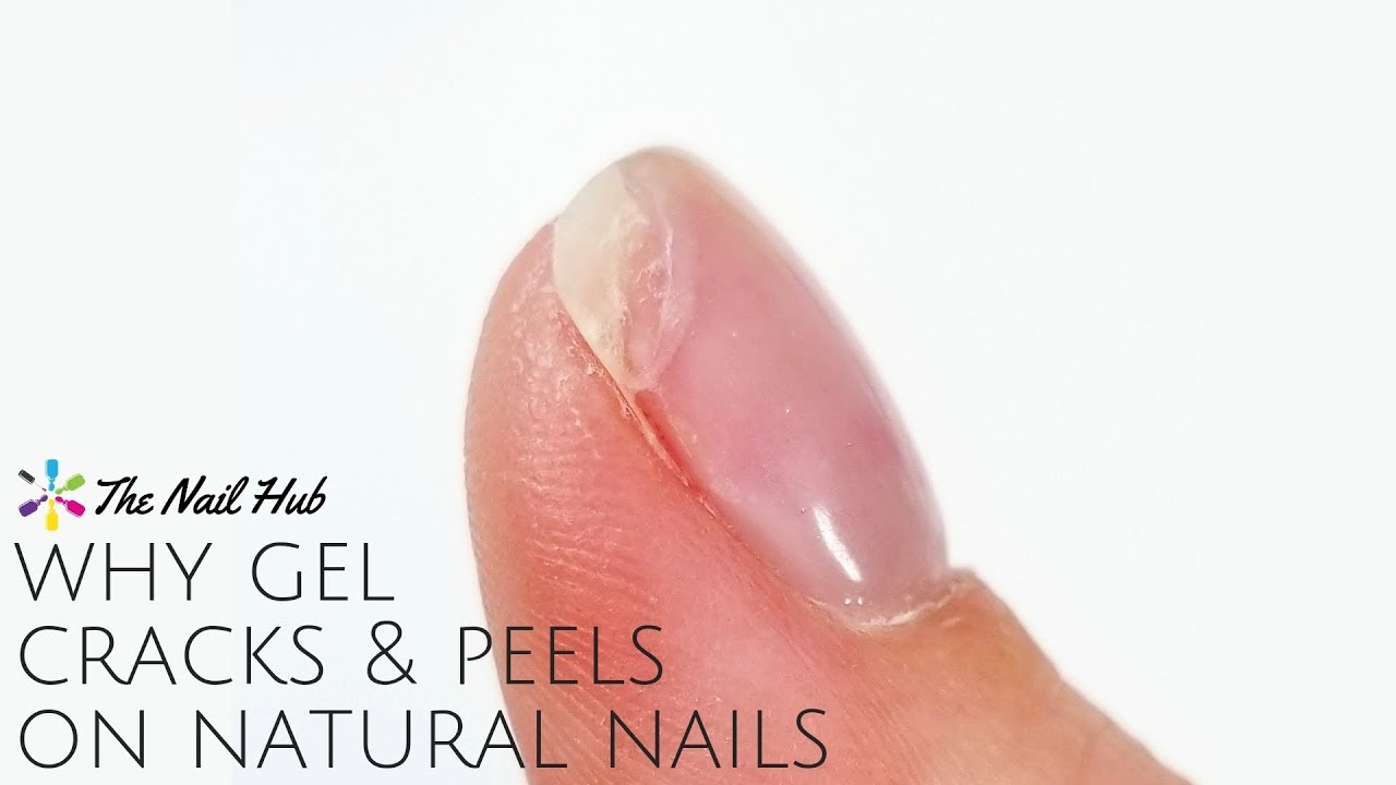 Why Gel Cracks, Peels & Separates