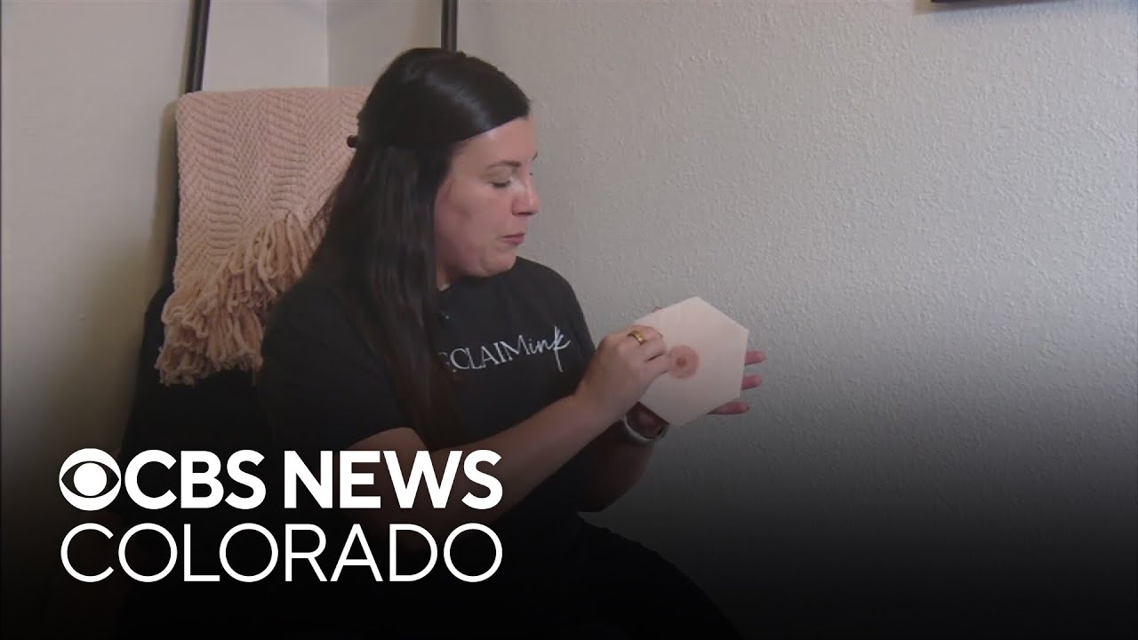 Medical tattoo artist specializes in tattooing nipples on breast cancer survivors