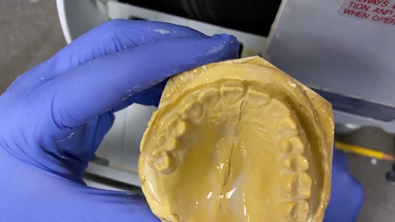 Grinding Dental Stone Study Models