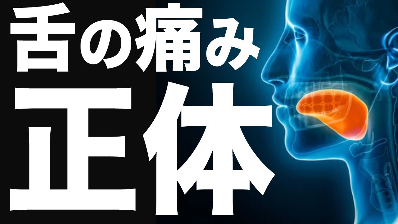 【舌がピリピリする】舌痛症の根本原因と30秒でできる解決法