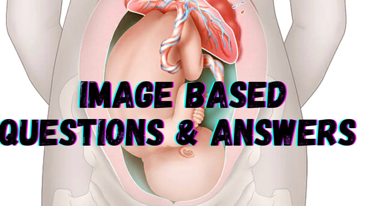 Image Based Questions And Answers || IBQ|| Obstetrics|| Nursing