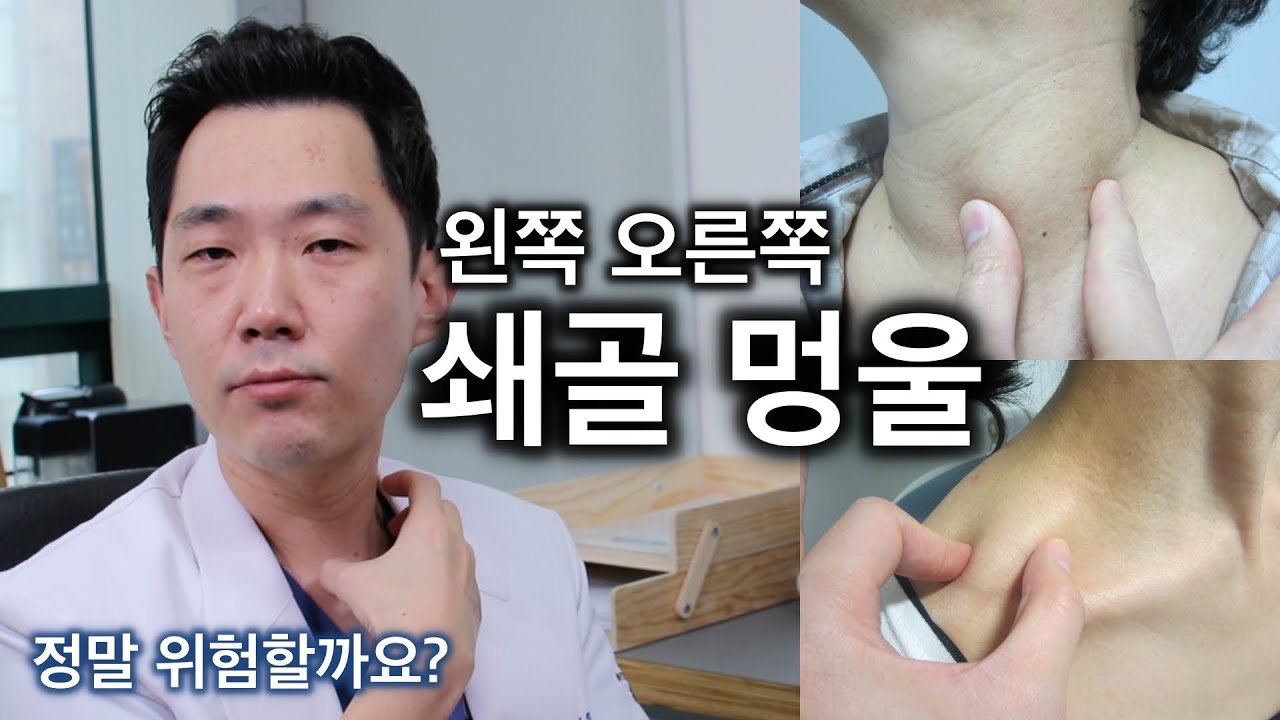 (오른쪽 왼쪽) 목 옆, 쇄골에 멍울, 림프절 - 정말로 위험한 위치인가요? 팩트만 정리해봅니다 : 위드심의원 조우진 원장