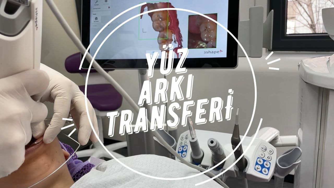 Kliniğimizde Kullandığımız Yöntemler - Yüz Arkı Transferi - Orto Akademi