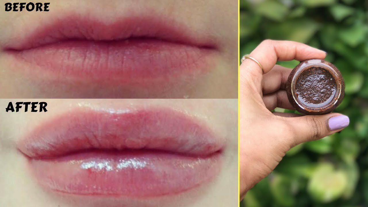 How To Get Bigger And Fuller Lips Naturally In Just 5 Minutes | Home Remedies