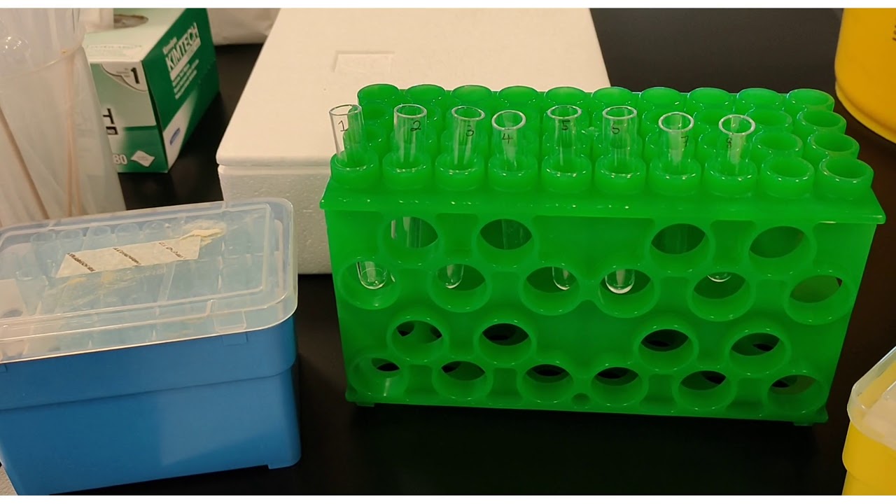 Enzyme kinetics practical demo: Measuring Km and Vmax of an alcohol dehydrogenase (BMN1004/B/P03)