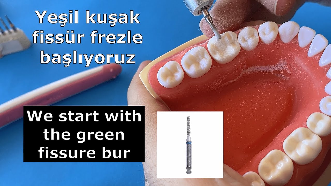 Mandibular Molar Crown Preparation Detailed | Mandibular Molar Diş Preparasyon(Kesim)