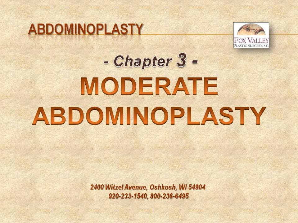 FVPS Abdominoplasty - Chapter 3