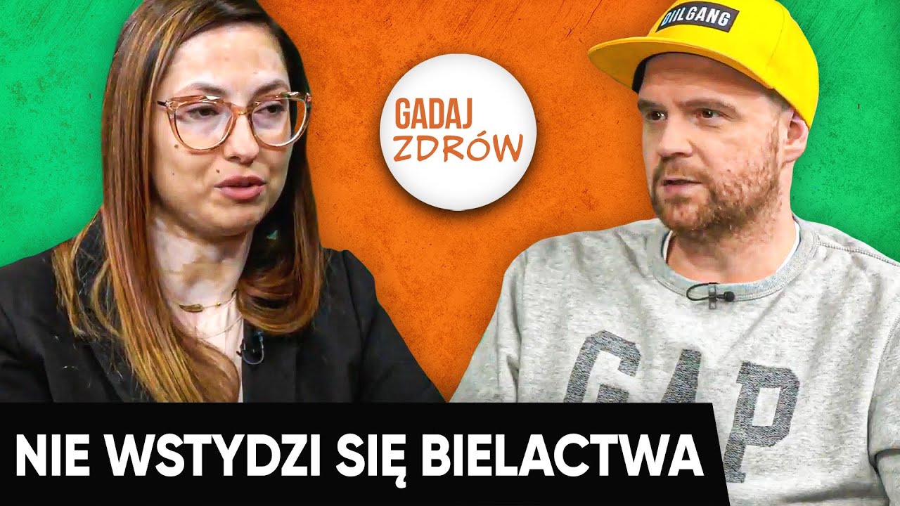 BIELACTWO - choroba nieuleczalna? | Gadaj Zdrów