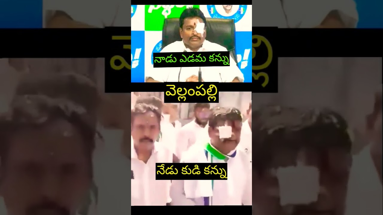 Vellampalli Srinivas drama on stone attack | YSRCP | YS Jagan | Vijayawada