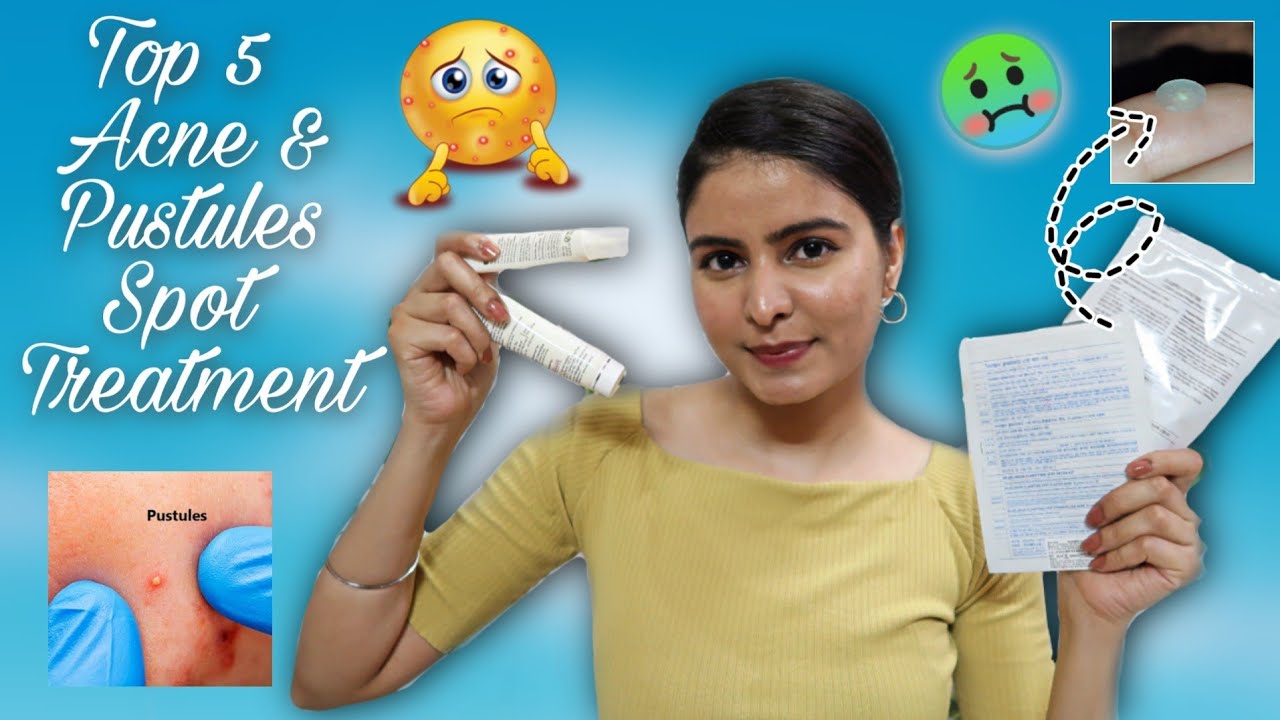 Best Acne Spot Treatments in India | How to use ? Kashika Chauhan