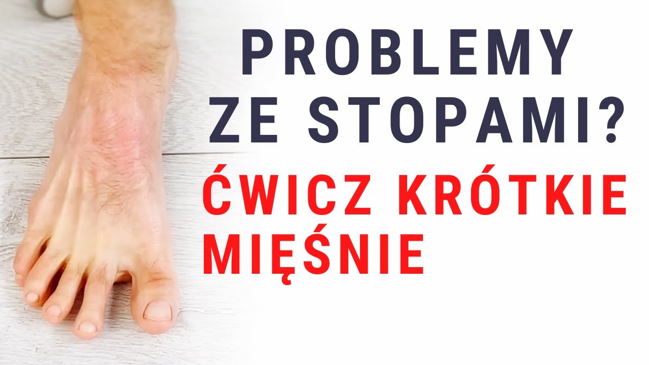 B&Oacute;L STOPY - na haluksy i inne problemy - ćwicz kr&oacute;tkie mięśnie - dr n. med. Marcin Wytrążek