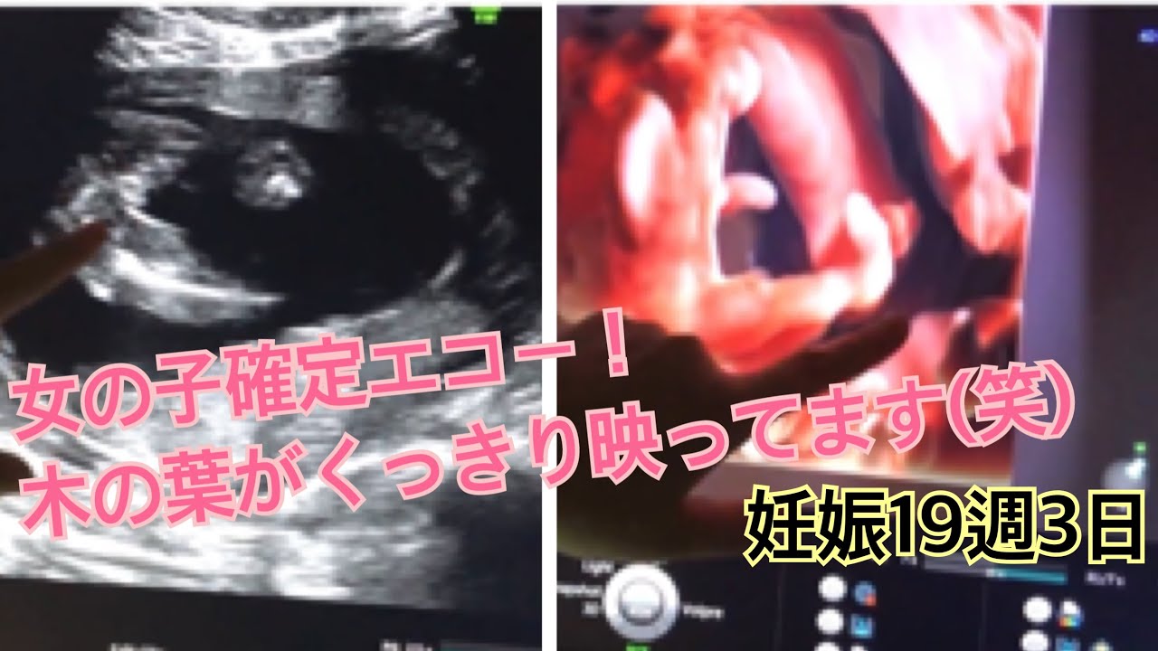 【妊娠19週3日】リベンジ版！性別確定〜！しっかり見えました！【4Dエコー】