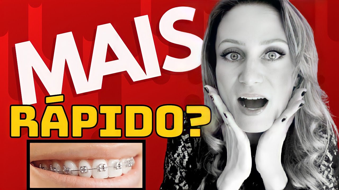 Posso fazer mais de uma manutenção por mês?🤔 #aparelhoortodôntico #dravanessagualda