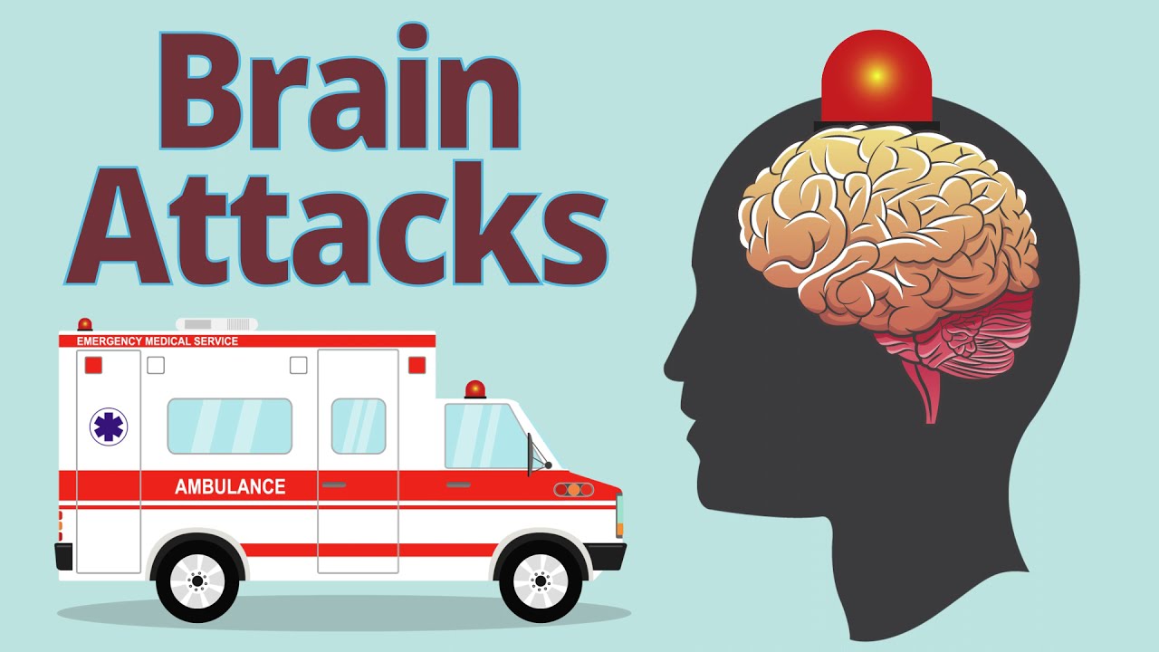 How Stroke Affects the Brain