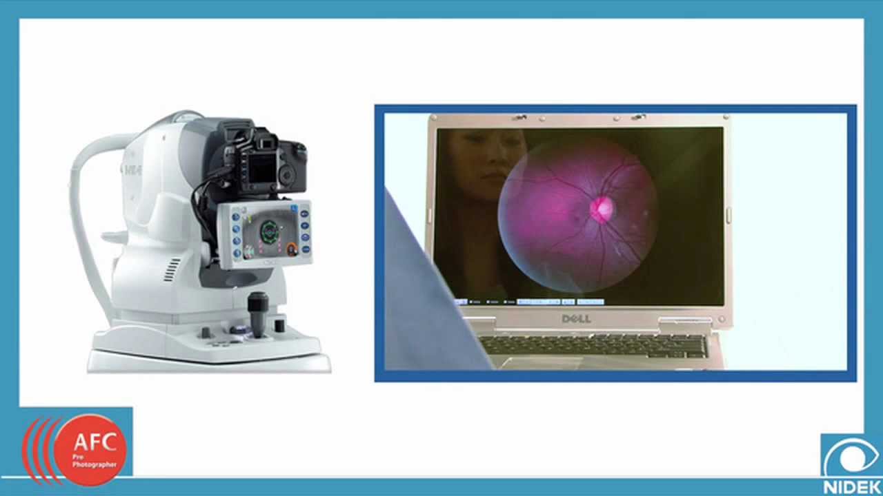 Auto Fundus Camera - About the Nidek AFC.mp4