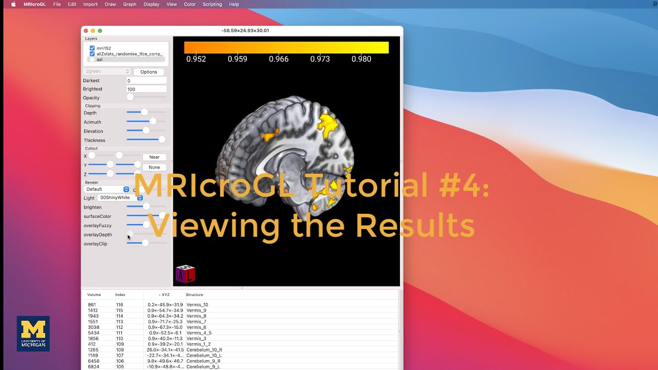 MRIcroGL Tutorial #4: Viewing the Results