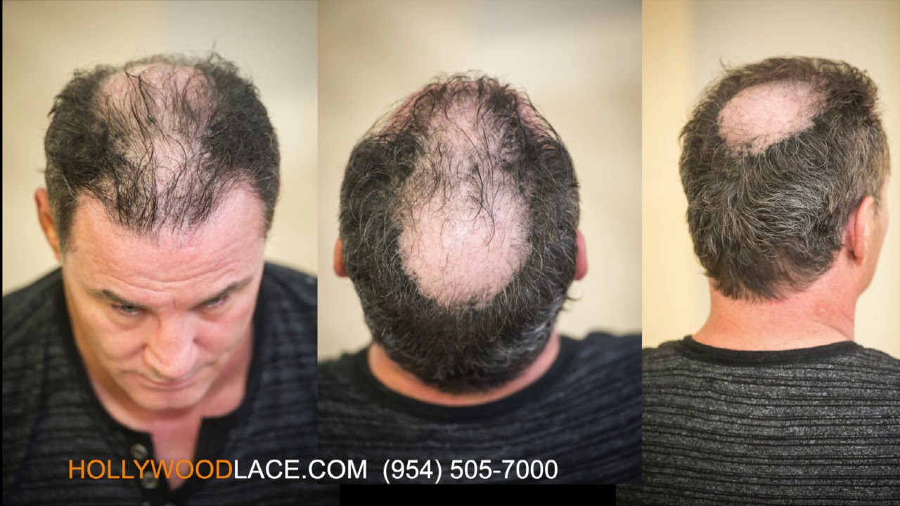 Hair System, Toupee, Hairpiece For Men  Hollywood Lace