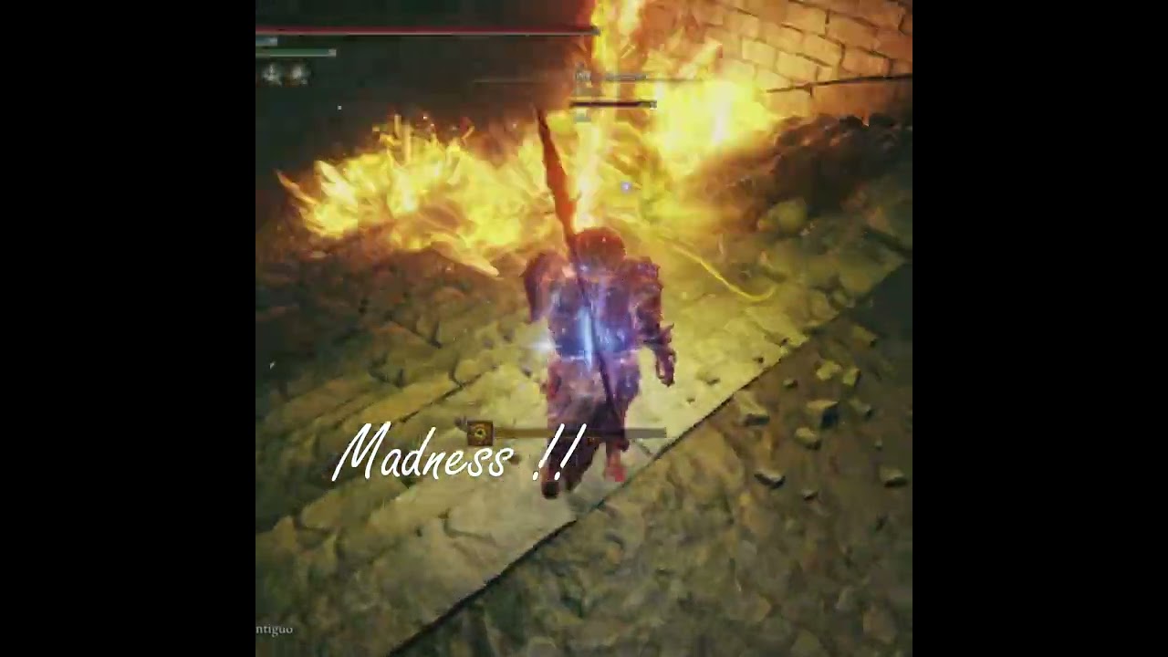 Unendurable FRENZY !! 😱😱 Elden Ring PvP