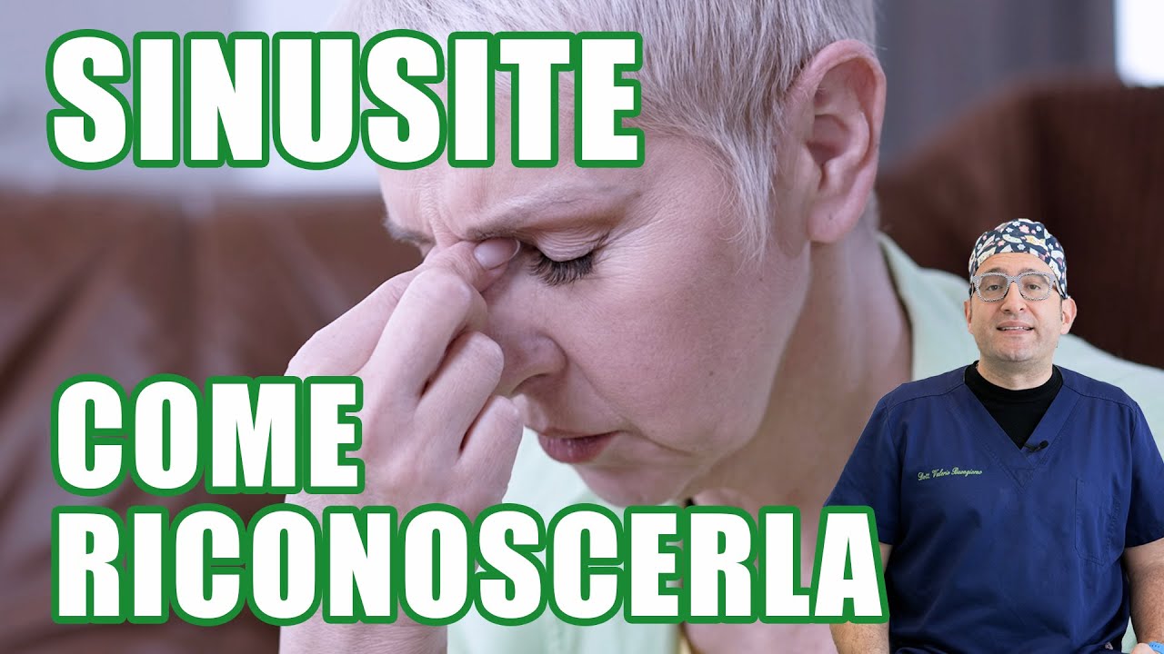 Sinusite cronica scopri subito se ne soffri