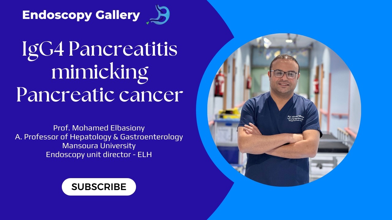 Autoimmune Pancreatitis Mimicking Pancreatic Cancer