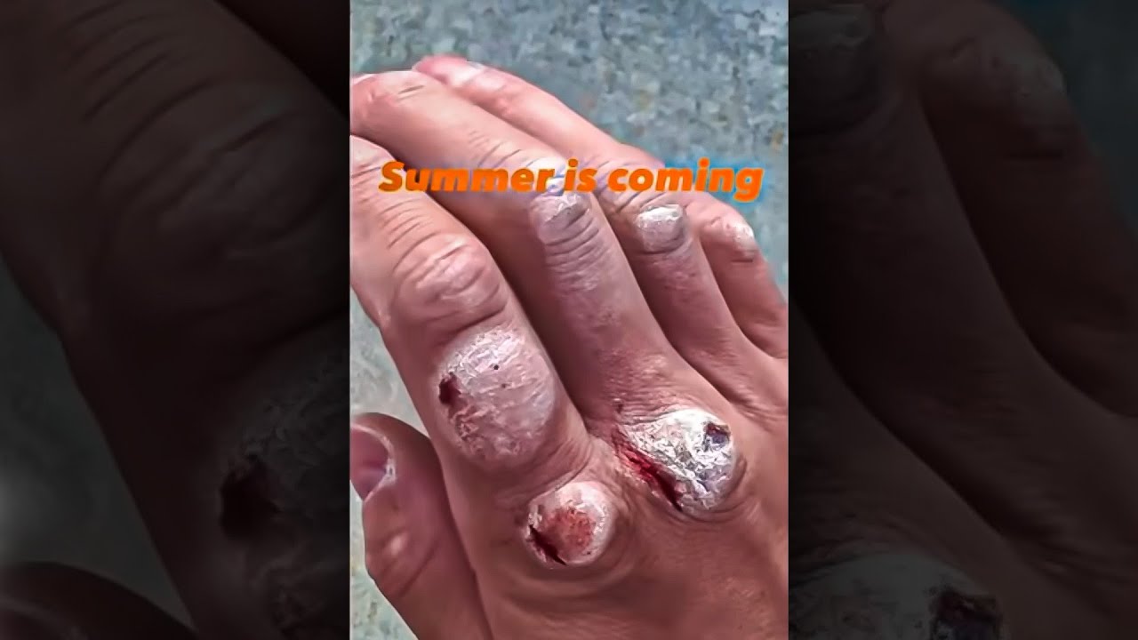 “Bro Got Soft Hands” 🤦‍♂️