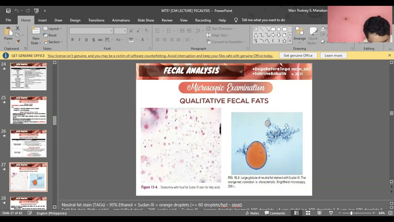 MT 51: Didactics | Clinical Microscopy Review (Fecalysis Part 2, Gastric Fluid, & Duodenal Contents)