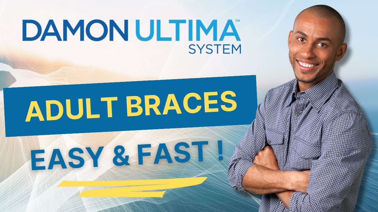 Damon Ultima System: Adult Braces Easy and Fast