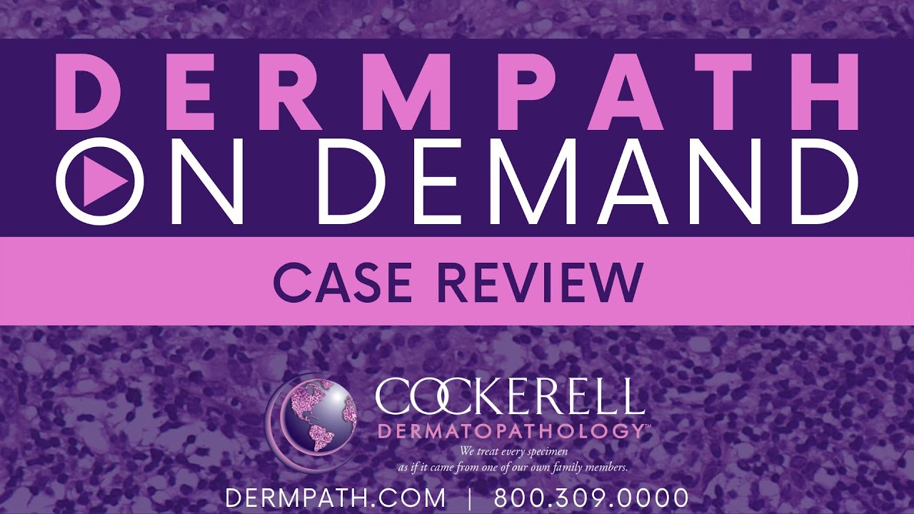 Case Review | Episode 2
