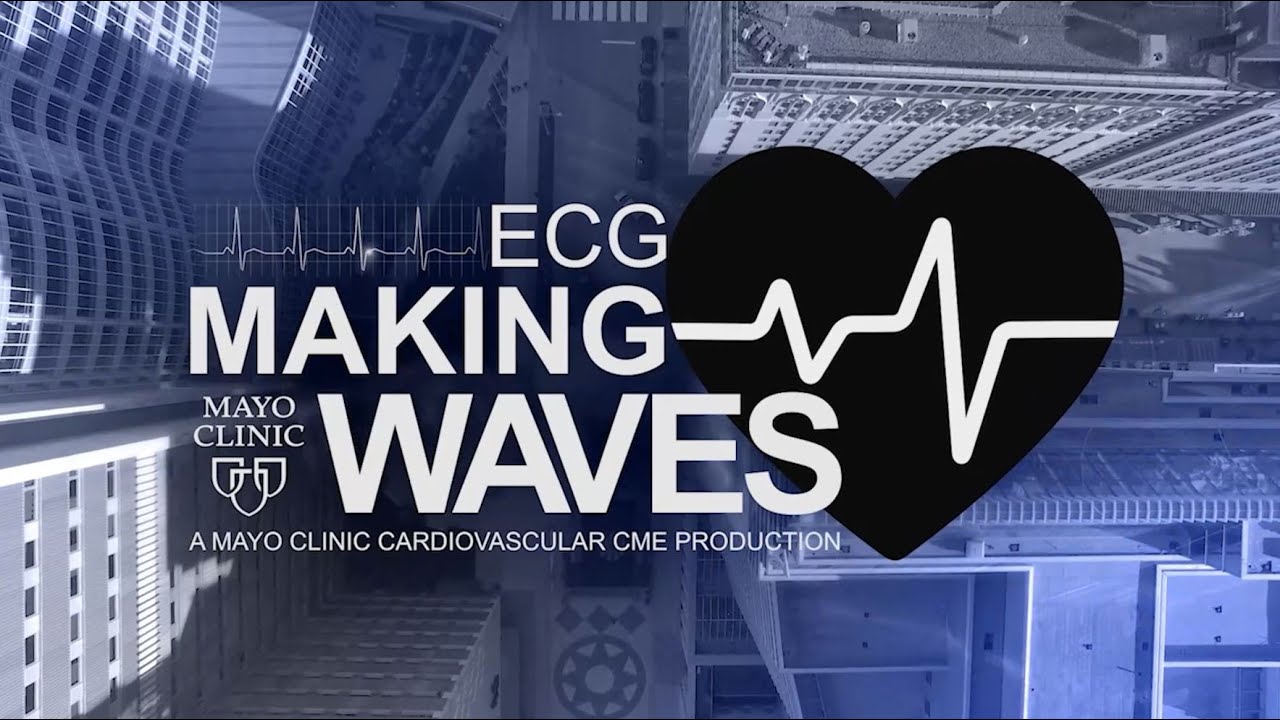 Computerized ECG Interpretation Software