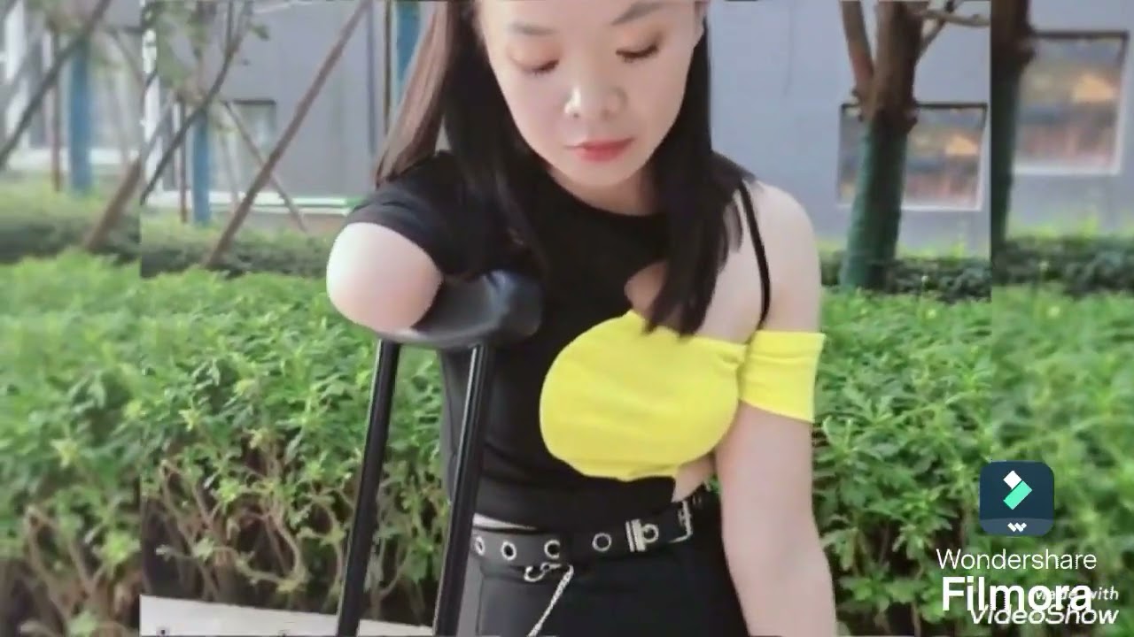 A beautiful woman with an amputated leg and arm who walks on one leg and one crutch #adaptive