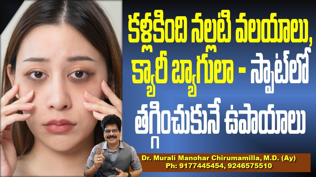 కళ్లకింది క్యారీ బ్యాగులా - తగ్గించుకునే ఉపాయాలు | Dark Circles Under The Eyes: Causes & Treatments