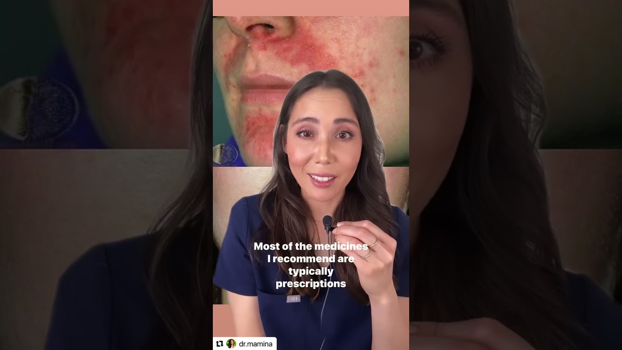 How to treat Perioral Dermatitis | Dr. Mamina, Board-Certified Dermatologist