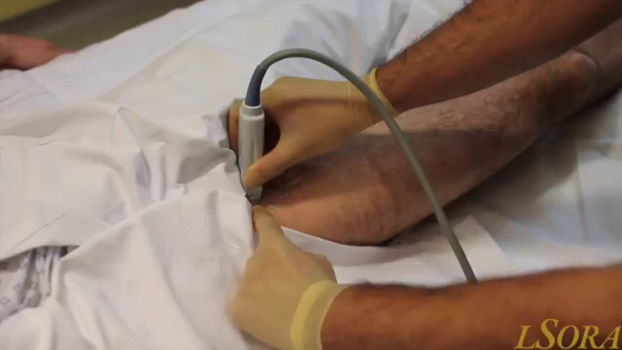 LSORA: Ultrasound Guided Femoral Nerve Block Tutorial