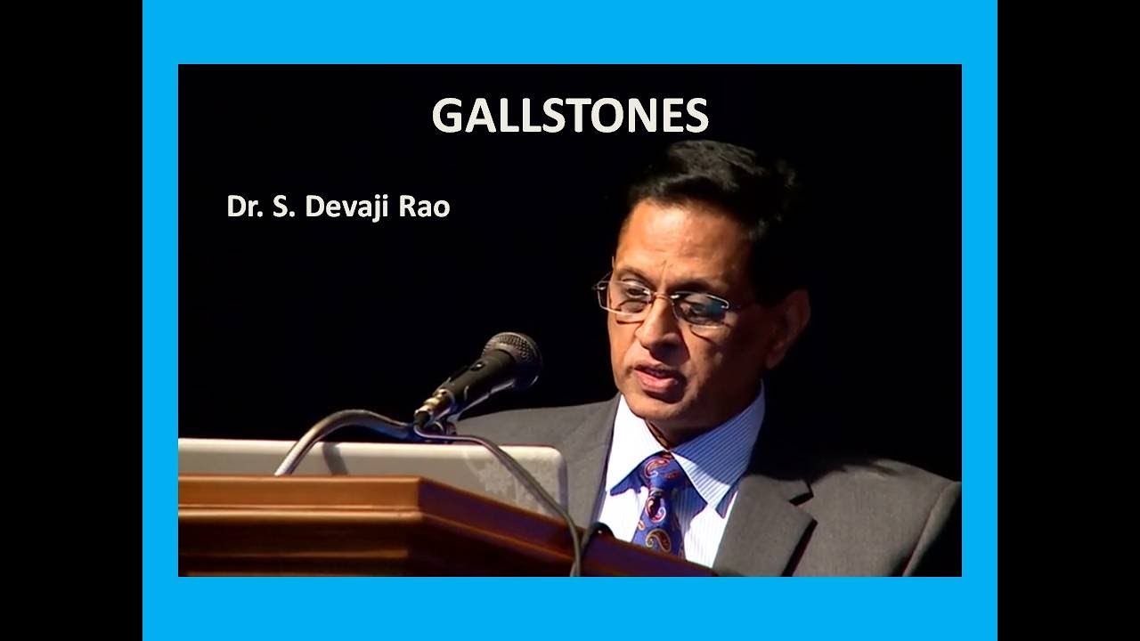 gallstones