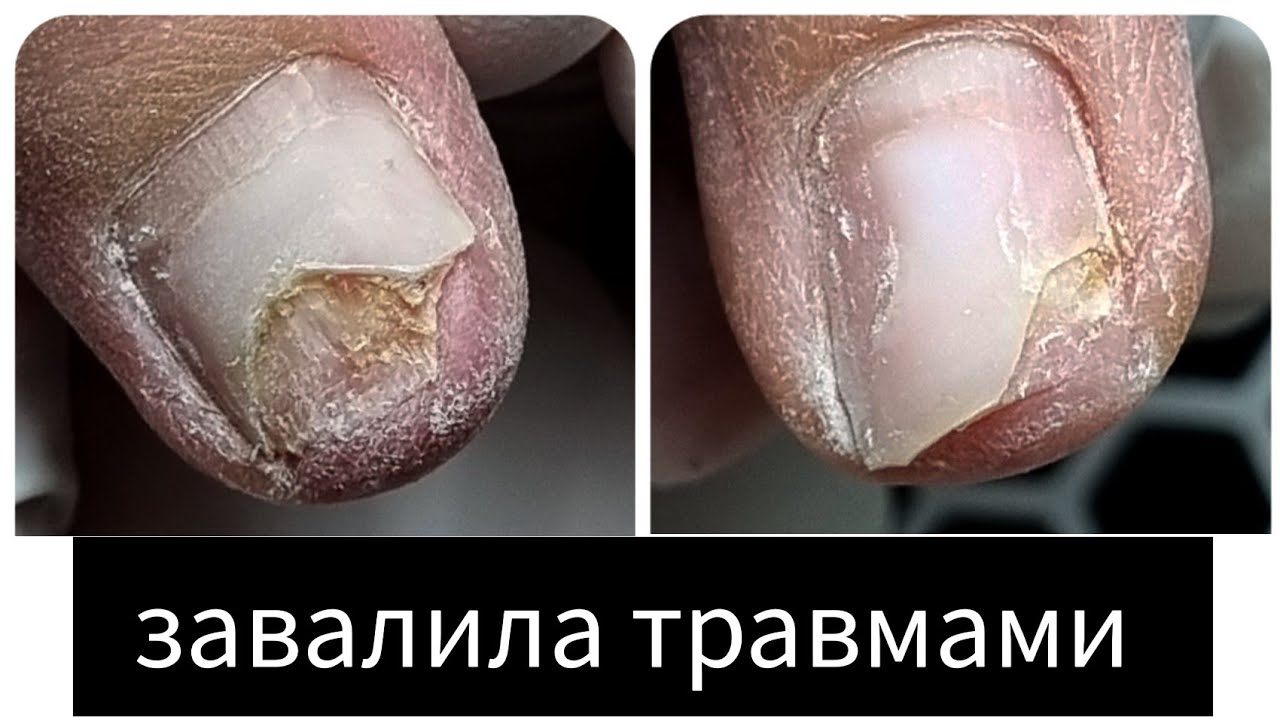 что она делает НОГТЯМИ? 🤬