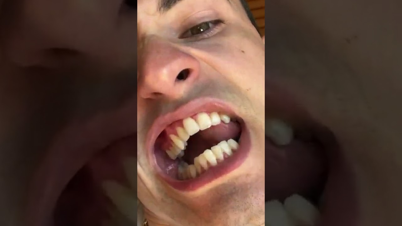 INSANE 90&deg; TONGUE ROLL 🔥