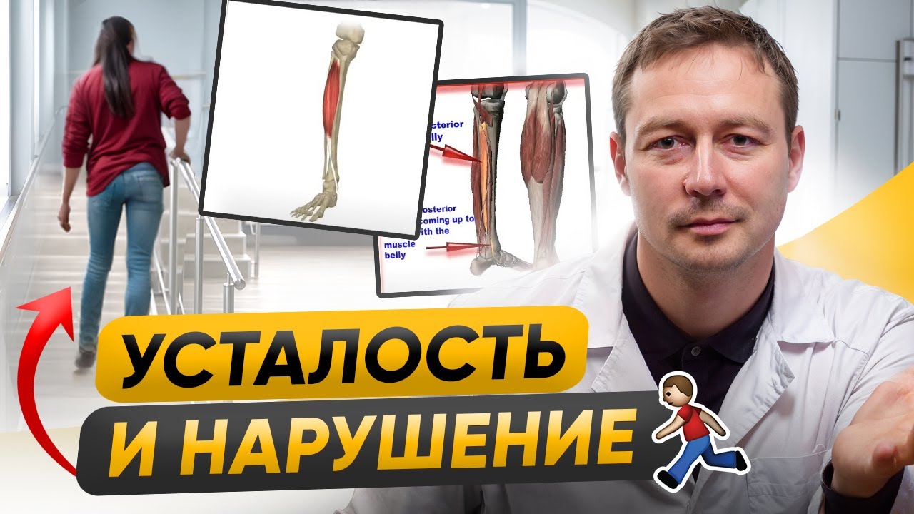 ОБОСТРЕНИЕ рассеянного склероза. Изменение походки и усталость