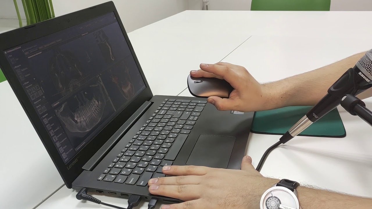 Горячие клавиши в OnDemand 3D Dental